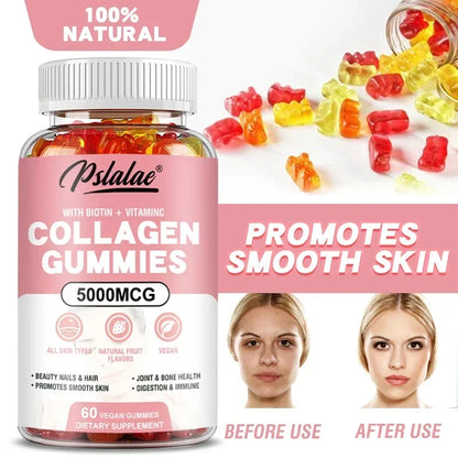 Collagen Gummies